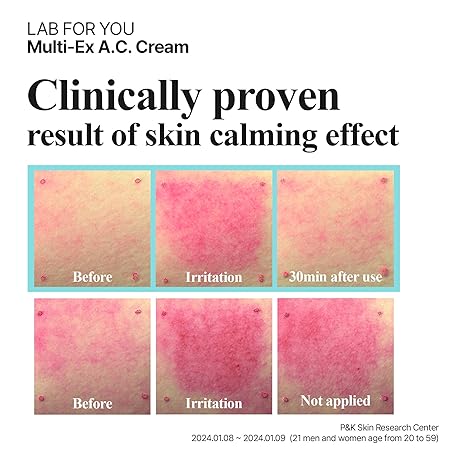Lab for you Multi-Ex A.C. Cream 20ml