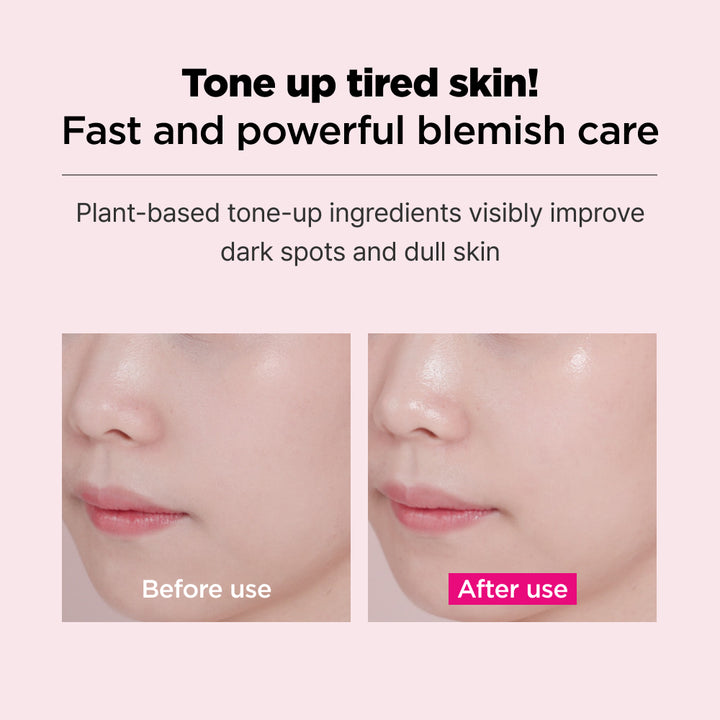 ISOI Blemish Care Mask [10Stk.]