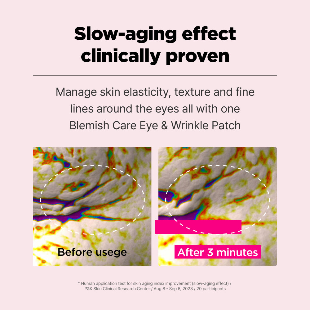 ISOI Blemish Care Eye & Wrinkle Patch [90 Stk.]